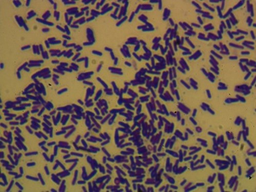 Lysinibacillus Spp