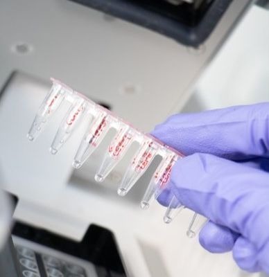 PCR tubos de ADN