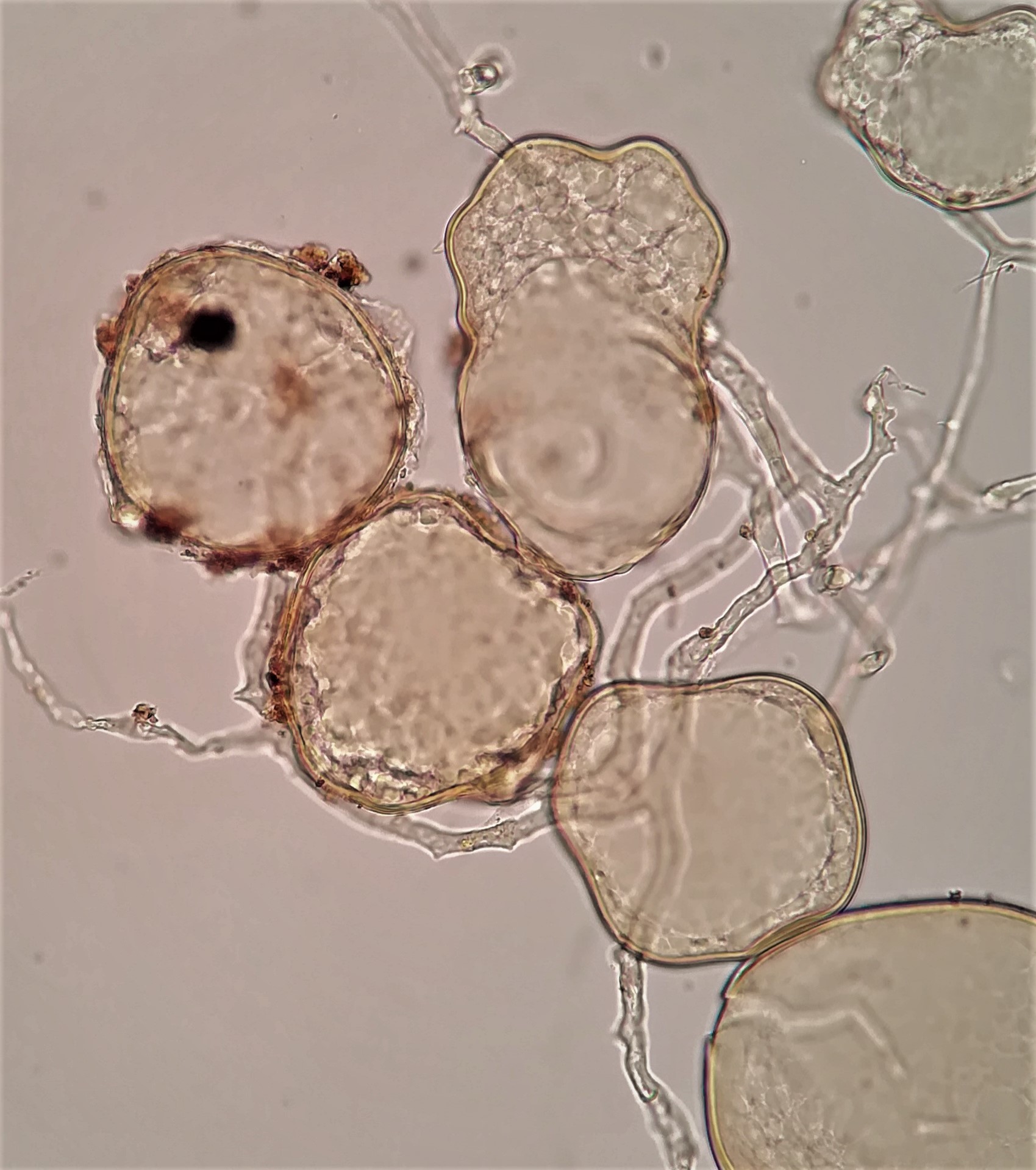 Rhizoglomus Irregulare