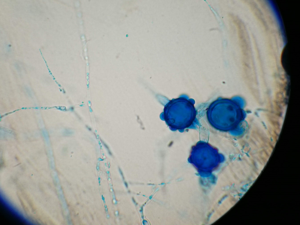 Revolucionario estudio de AGROSAVIA revela el potencial de hongos nematófagos nativos para controlar nematodos gastrointestinales en ovinos