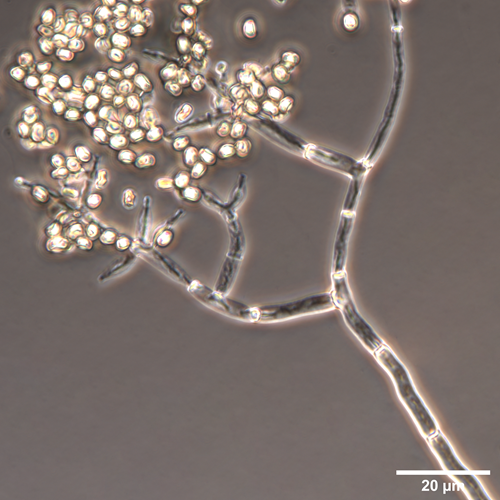 Trichoderma Sp Microscopico