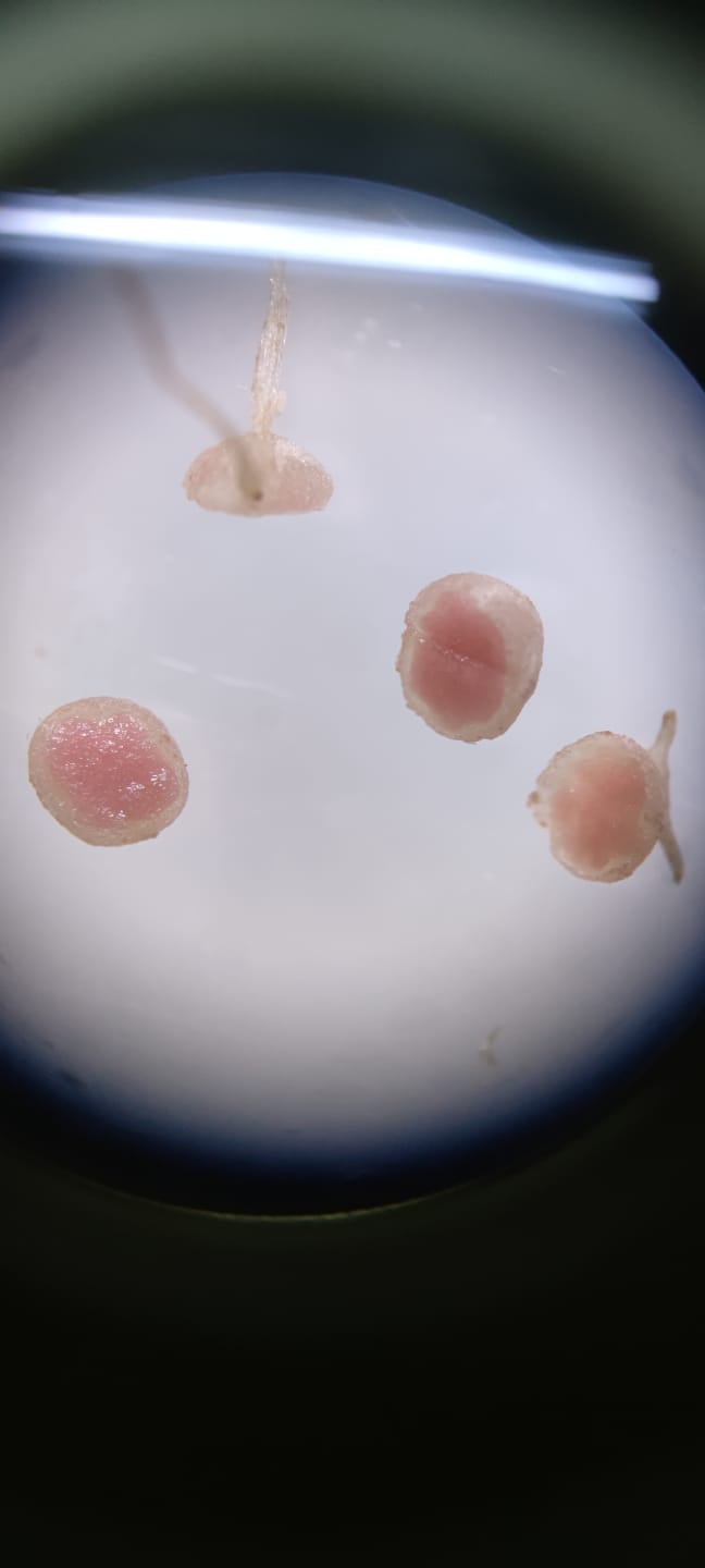 AGROSAVIA Vincula A Su Primer Becario Postdoctoral En Investigación Que Busca Aumentar La Producción De Frijoles En El Cesar7